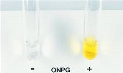Beta-Galactosidase Test (ONPG)